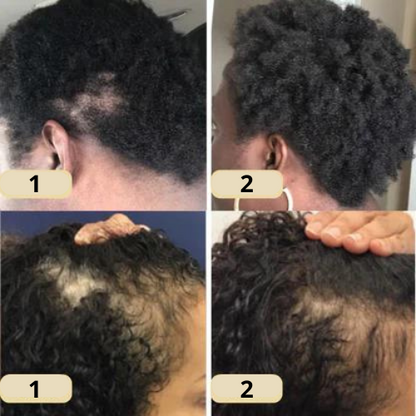 Eelhoe™ | Natural oil for hair growth