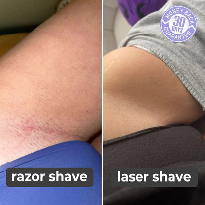 LaserRemover™ | Waxing quality results from the comfort of home